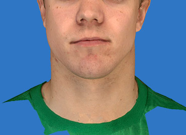 Facial Sculpting 3d Simualtion